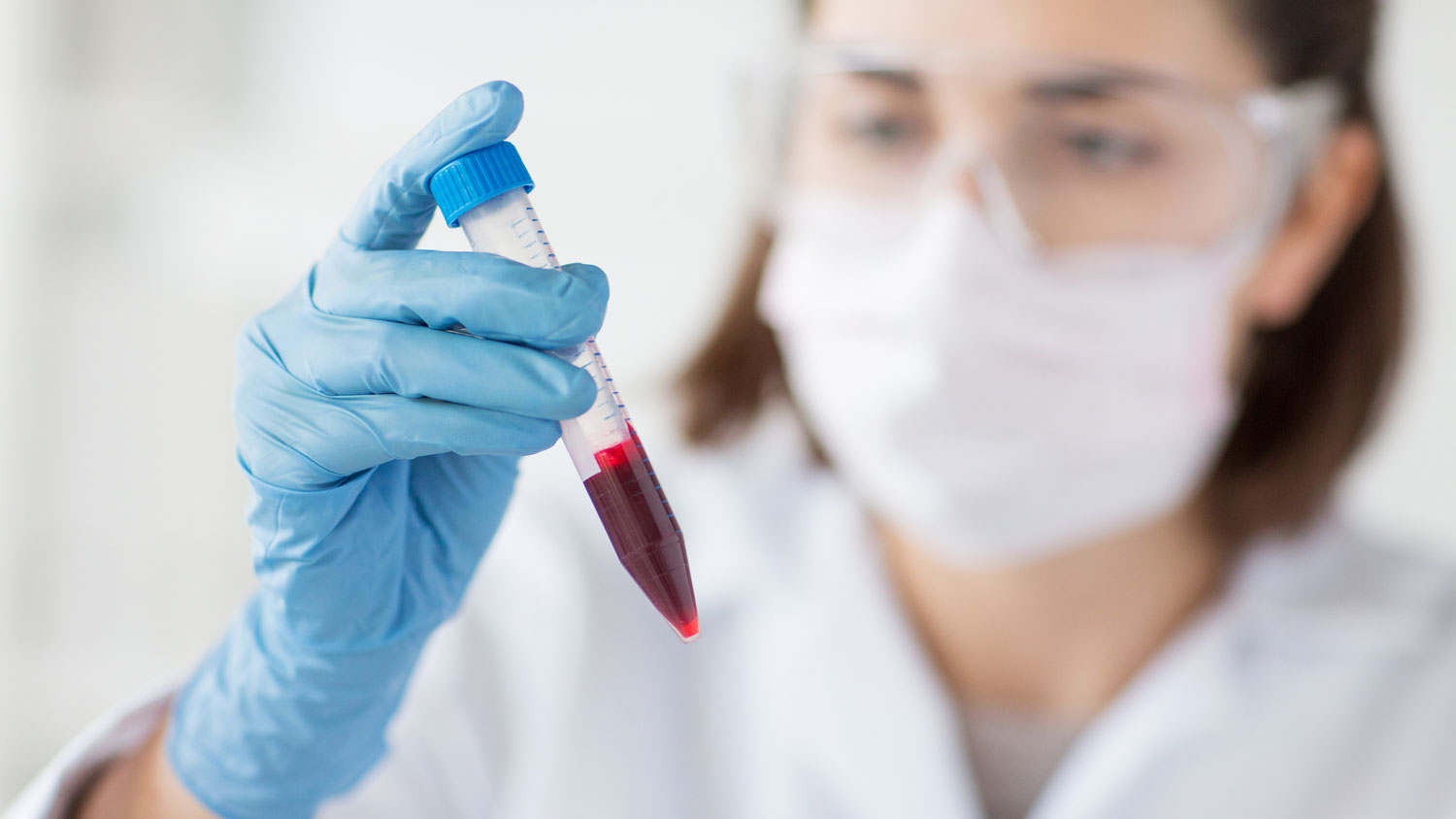 blood test - Early Cancer Detection for Proactive Risk Management-oncology, cancer-Oncology