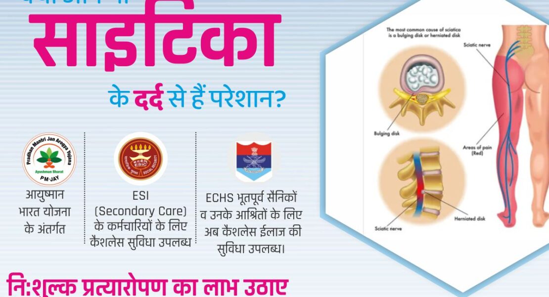 4 1110x601 - साइटिका लक्षण, बचाव व उपचार-general-साइटिका लक्षण, साइटिका बचाव, साइटिका उपचार